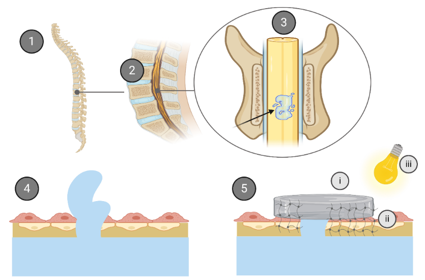 High-Performance Tissue Adhesive for Dural Repair